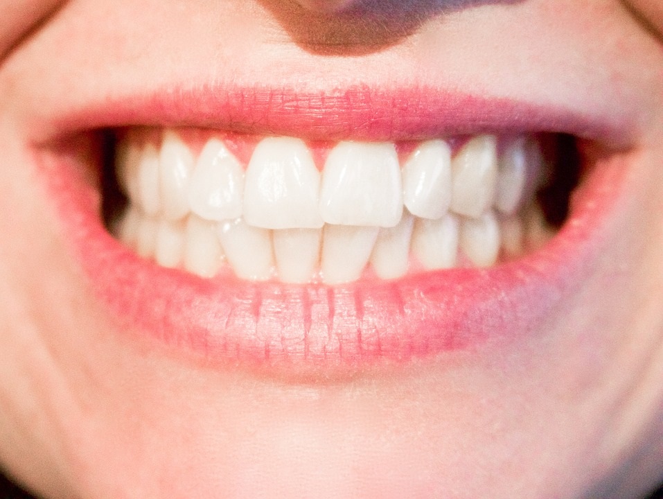 So einfach können Sie Hohlräume zwischen den Zähnen vermeiden