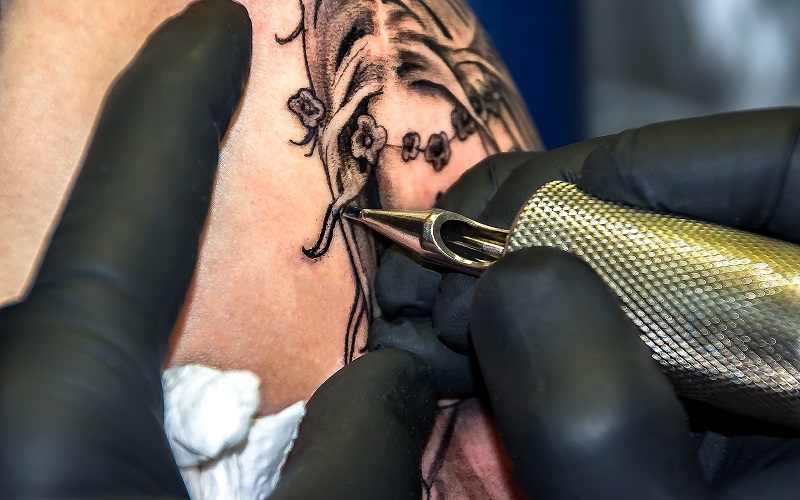 tattoo_entfernen_mit _laser