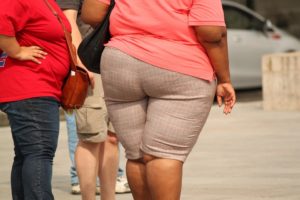 Ist ein Lipödem mit Fettleibigkeit verbunden?