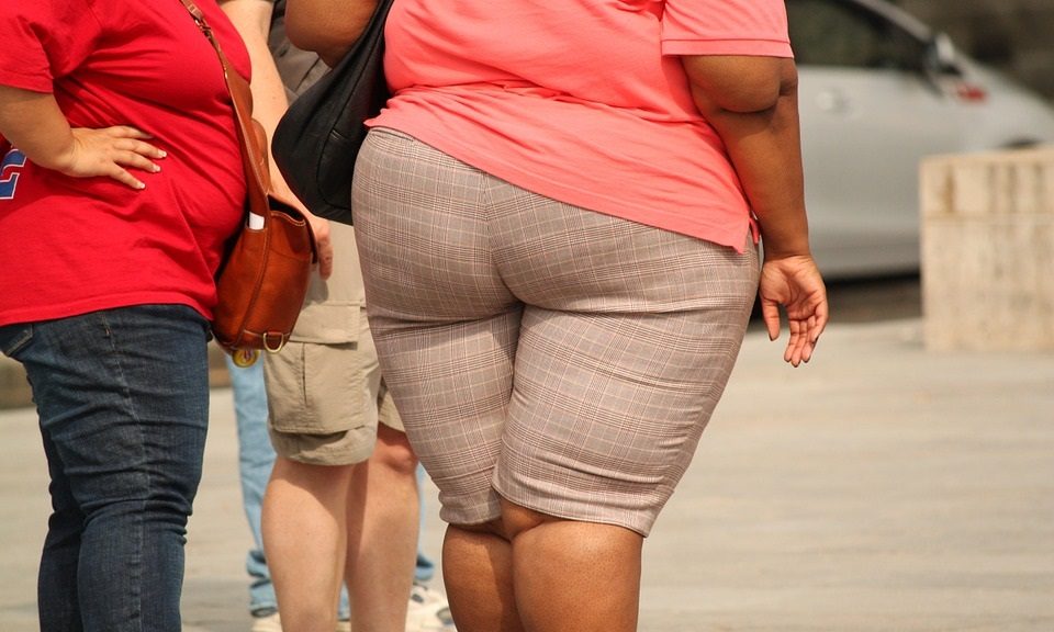 Ist ein Lipödem mit Fettleibigkeit verbunden?