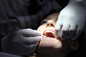 5 Gründe, warum Zahnpflege wichtig ist