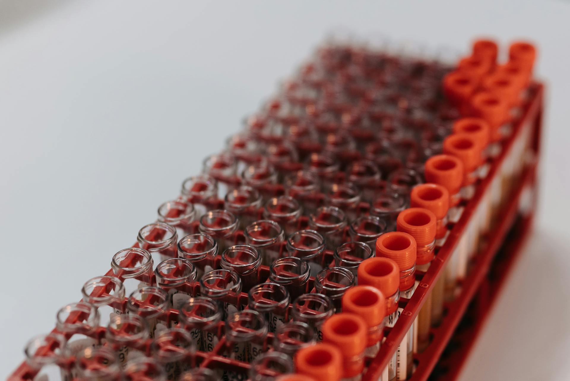 PRP-Eigenblutbehandlung (Vampirlift) –